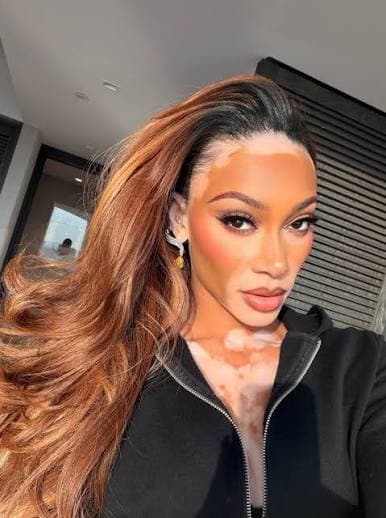 Winnie Harlow